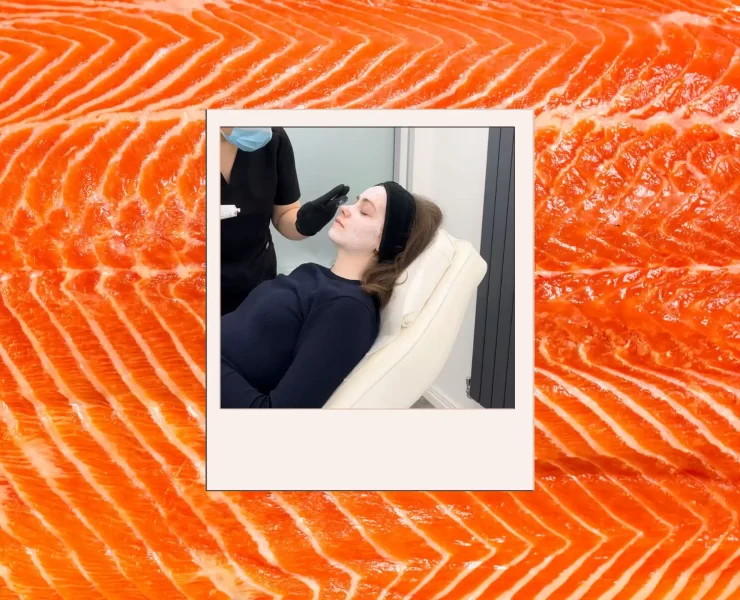 A close-up of a skincare treatment at The Secret in Govan, Glasgow, showcasing the application of the viral salmon sperm facial with Dr. Kaly Gaff. The treatment involves using polyneucleotides to enhance skin health, targeting acne scars, fine lines, and pigmentation.